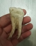 Зуб 3