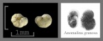 Foraminifera-28 Anomalina (granosa ?)