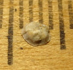 Nubecularia cristellaroides Terquem.