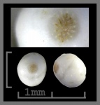 Foraminifera-25
