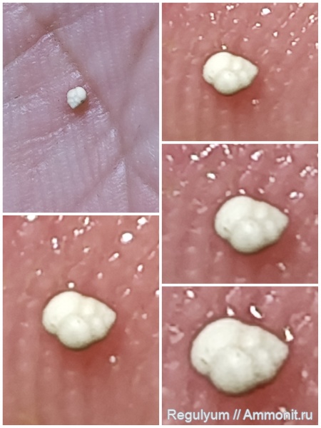 фораминиферы