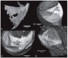 Изучены челюсти аммонитов каменноугольного периода